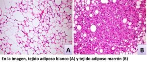 ADIPOSO Comparacion 300x126